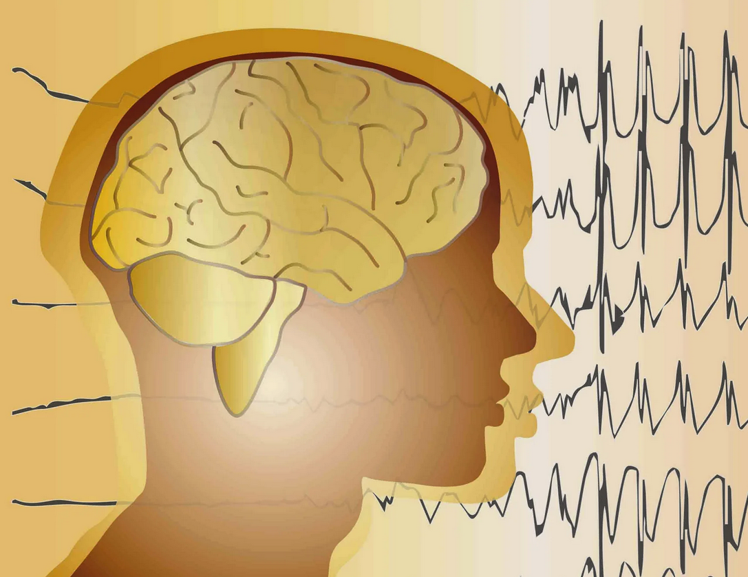 Роландическая эпилепсия у детей